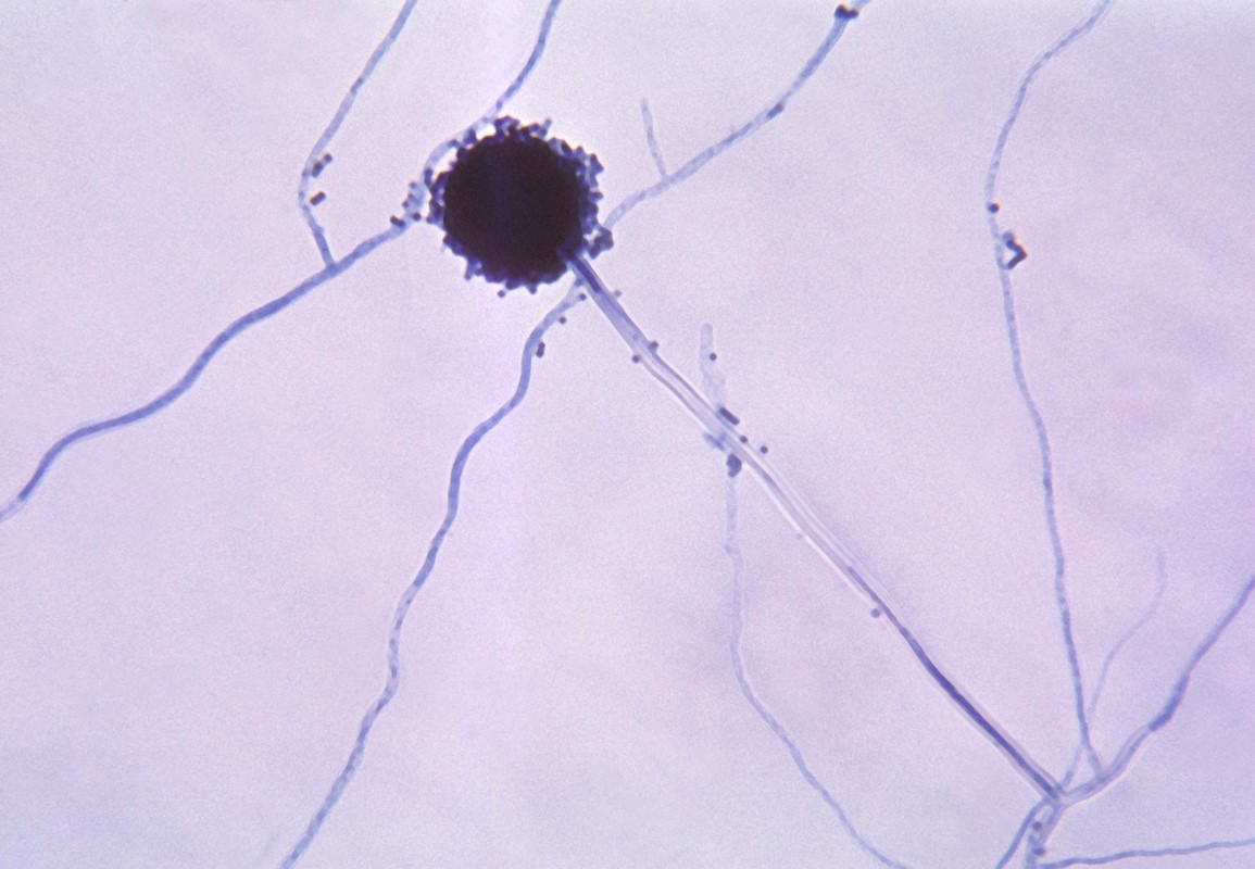 📷 CDC/Dr. Lucille K. Georg (Wikipedia)